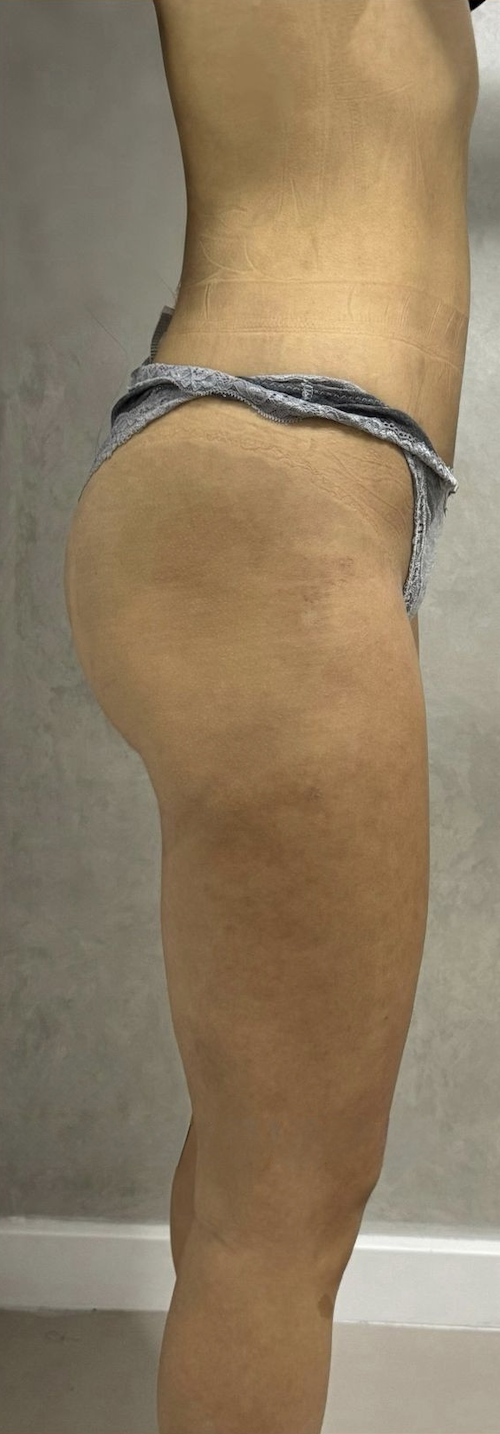 Posle transformacije